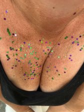 Is this too much exposure?