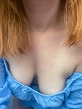 Do you think my little mole is cute?