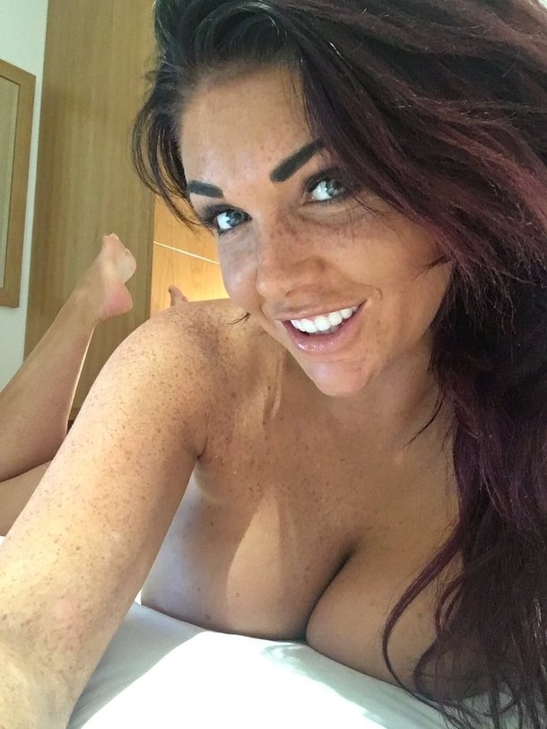 Freckles Are Sexy