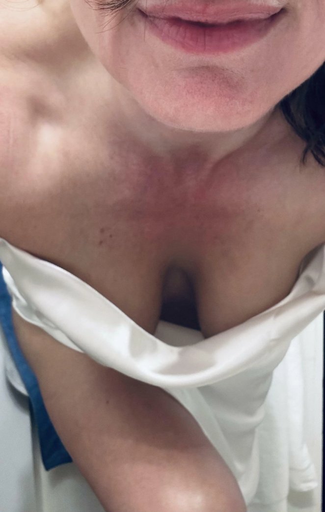 Unmistakably Blatant