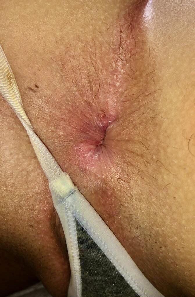 Virgin 20 yr old hole! She says if you give her enough encouragement shell let me take her anal virginity! Get at it!